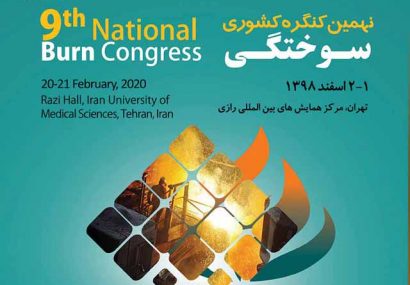 شیوع سوختگی الکتریکی در محیط کار