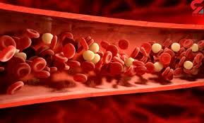 چگونه چربی خون خود را ارزیابی کنیم چگونه چربی خون خود را ارزیابی کنیم