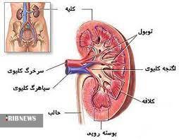 شناسایی۲۳۱ بیمار جدید دیالیزی در همدان