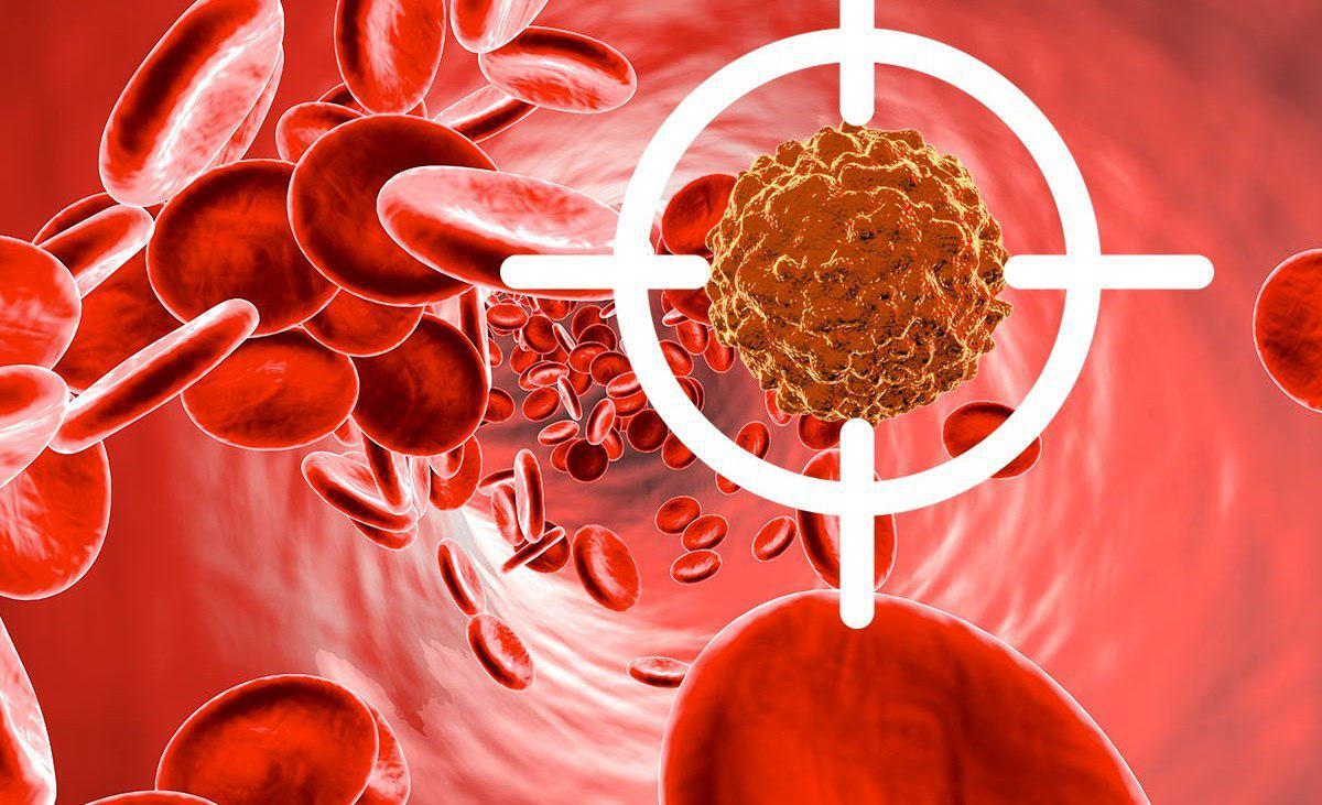 با حمایت بنیاد ملی علم ایران انجام شدتولید نانوسامانه جدید دارورسانی برای درمان موثرتر سرطان با حمایت بنیاد ملی علم ایران انجام شدتولید نانوسامانه جدید دارورسانی برای درمان موثرتر سرطان