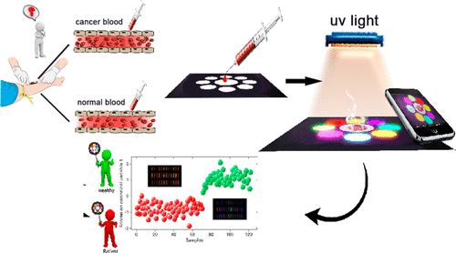 طراحی دستگاه بویایی نوری برای شناسایی زودهنگام سرطانهای خونی طراحی دستگاه بویایی نوری برای شناسایی زودهنگام سرطانهای خونی